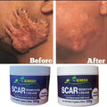 SMIO HEALTH Rapid Scar Remover Old And New Scars Achieve Smooth, Scar-Free Skin 120g