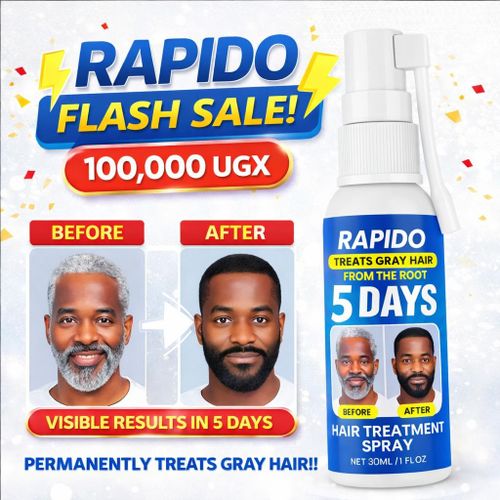 Rapido 5 DAYS Gray Hair Treatment Spray Gray Beards To Black Beard Growth – Restores Natural Black Hair From The Root – Fast Hair Color Renewal & Growth – 30ml