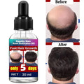 RAPIDO Hair Root Activator Shampoo - 30ml