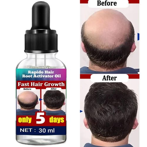 RAPIDO Hair Root Activator Shampoo - 30ml