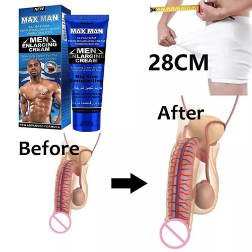 Max Man New Improved A Class Version Original Herbal Male Manhood Enlargementt Cream Must Have For All Men Free Delivery 10 X Better - 50g