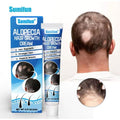 Sumifun Alopecia Hair Growth Cream: Your Ultimate Solution to Hair Loss